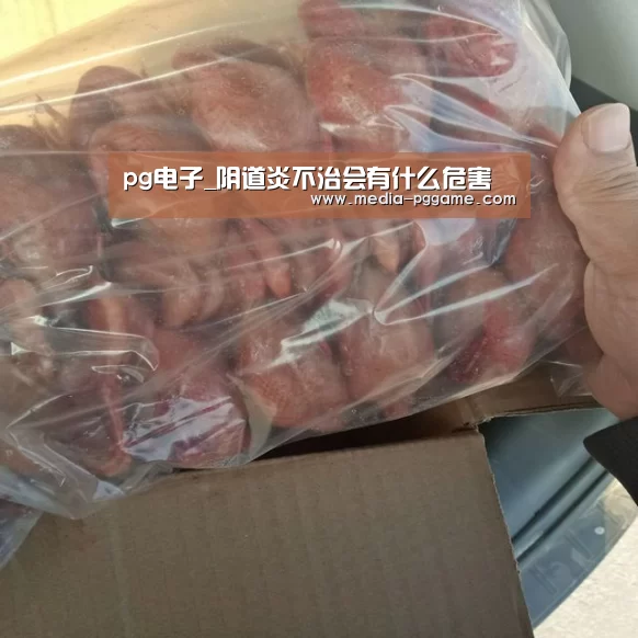 pg电子_阴道炎不治会有什么危害(图3) pg电子模拟器